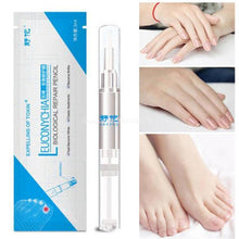 Load image into Gallery viewer, Bio Pen Nail Fungal Treatment Nails Accessories 1PC