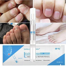 Load image into Gallery viewer, Bio Pen Nail Fungal Treatment Nails Accessories 1PC
