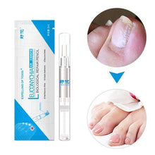 Load image into Gallery viewer, Bio Pen Nail Fungal Treatment Nails Accessories 1PC