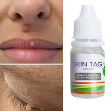 Load image into Gallery viewer, Skin Tag Remover Skin Care 1PC
